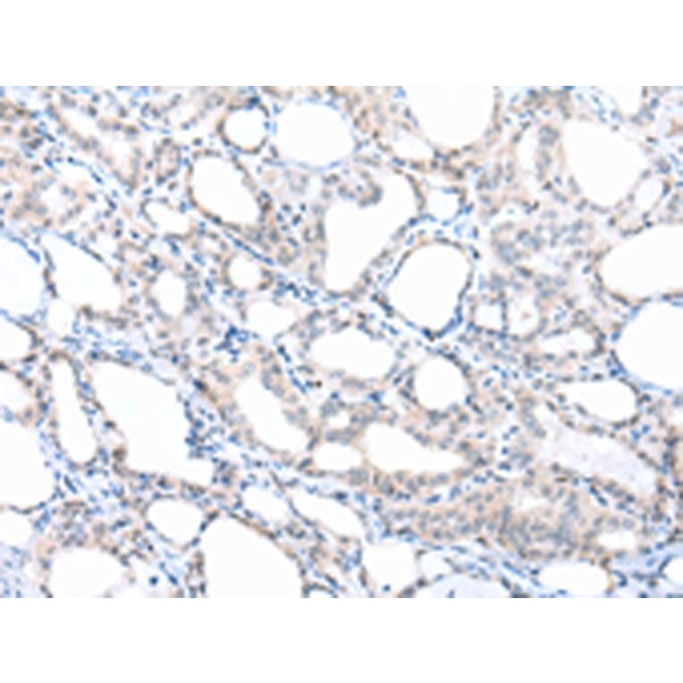 Immunohistochemistry - PPBP Antibody from Signalway Antibody (43092) - Antibodies.com
