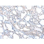 Immunohistochemistry - PPBP Antibody from Signalway Antibody (43092) - Antibodies.com