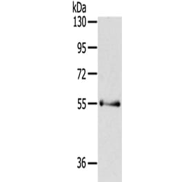 PAK3 Antibody from Signalway Antibody (43110) - Antibodies.com
