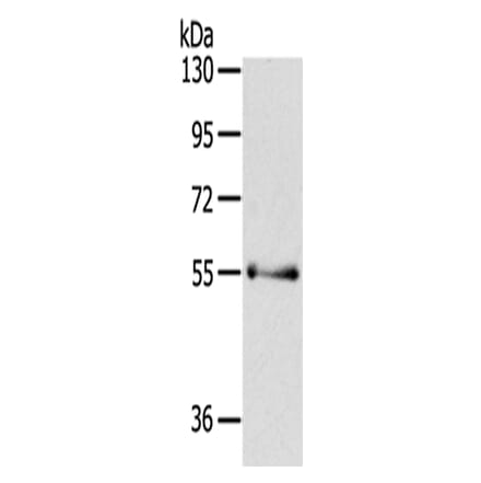 PAK3 Antibody from Signalway Antibody (43110) - Antibodies.com