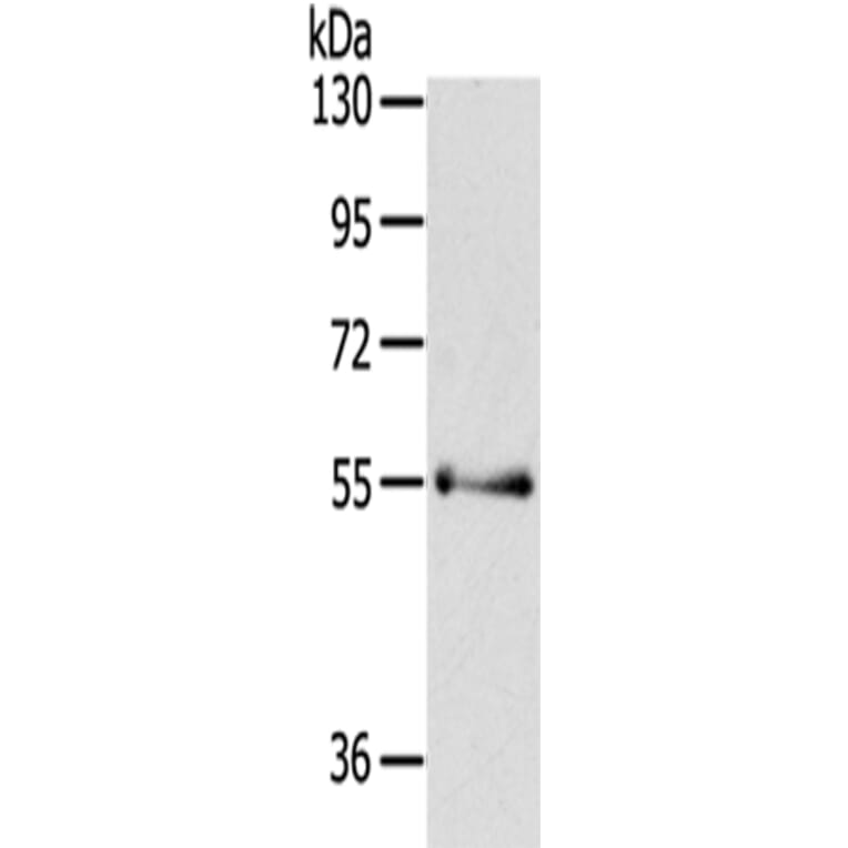 PAK3 Antibody from Signalway Antibody (43110) - Antibodies.com