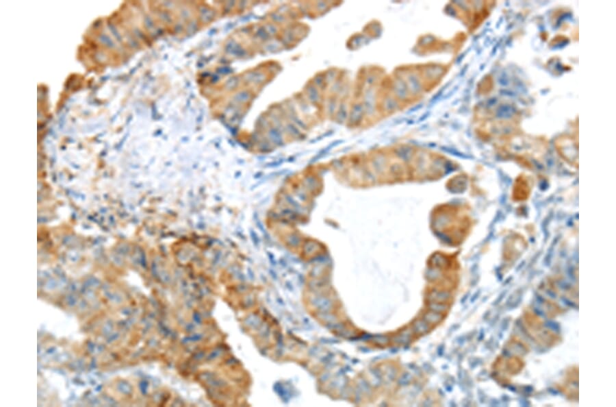 Immunohistochemistry - PAK3 Antibody from Signalway Antibody (43110) - Antibodies.com