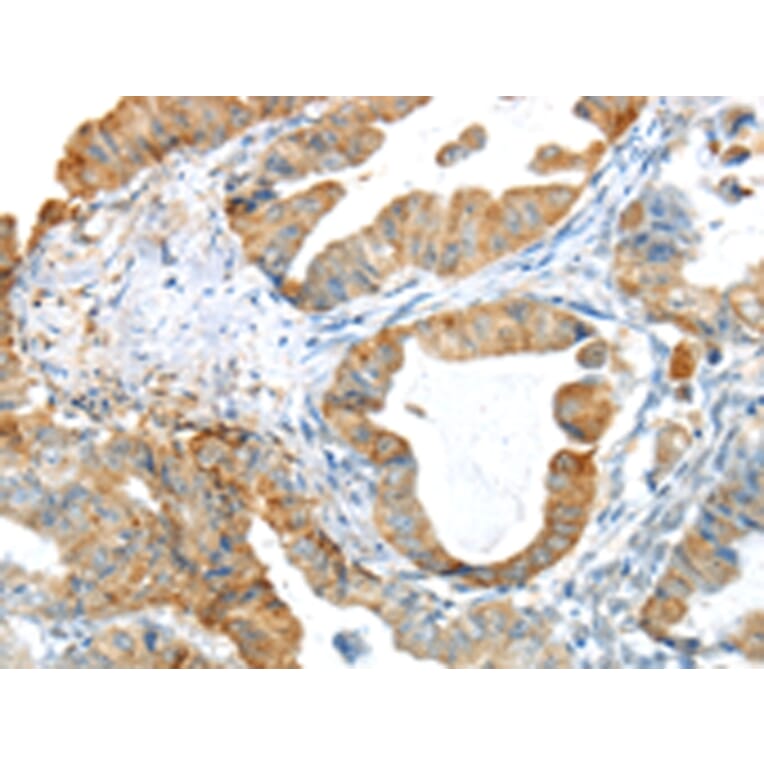 Immunohistochemistry - PAK3 Antibody from Signalway Antibody (43110) - Antibodies.com