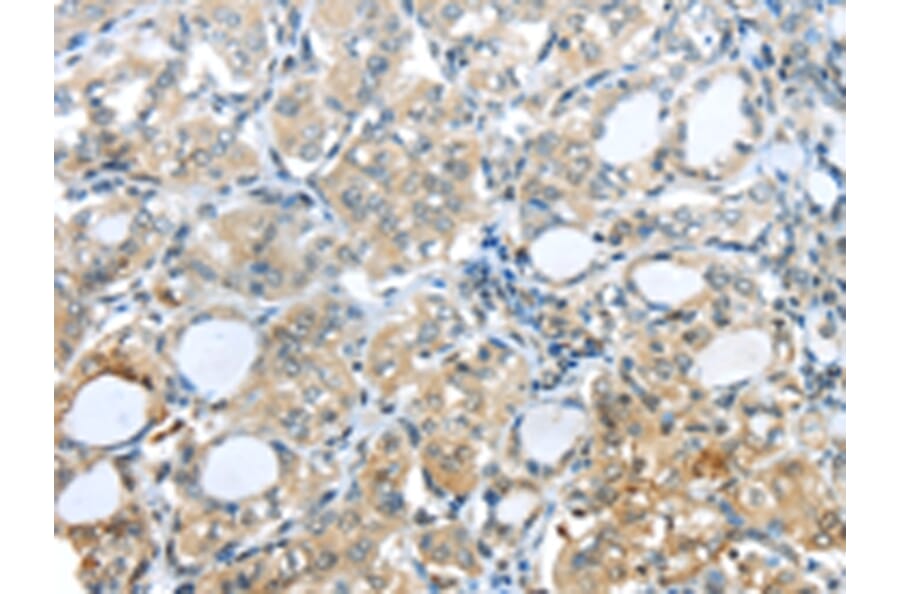 Immunohistochemistry - PAK3 Antibody from Signalway Antibody (43110) - Antibodies.com