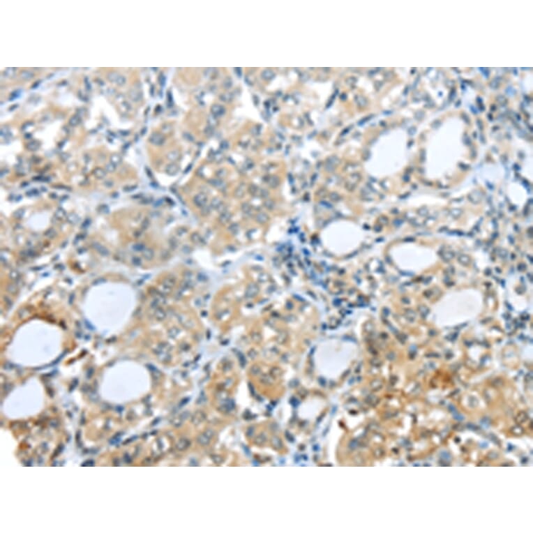 Immunohistochemistry - PAK3 Antibody from Signalway Antibody (43110) - Antibodies.com