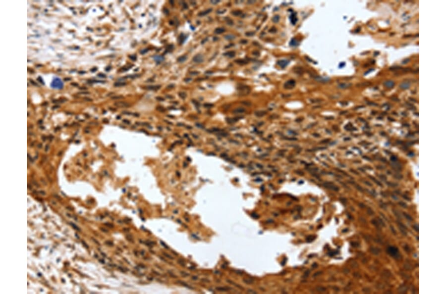 Immunohistochemistry - PTX3 Antibody from Signalway Antibody (43163) - Antibodies.com