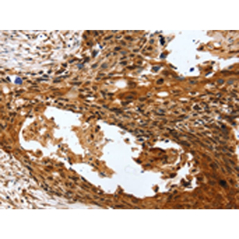 Immunohistochemistry - PTX3 Antibody from Signalway Antibody (43163) - Antibodies.com