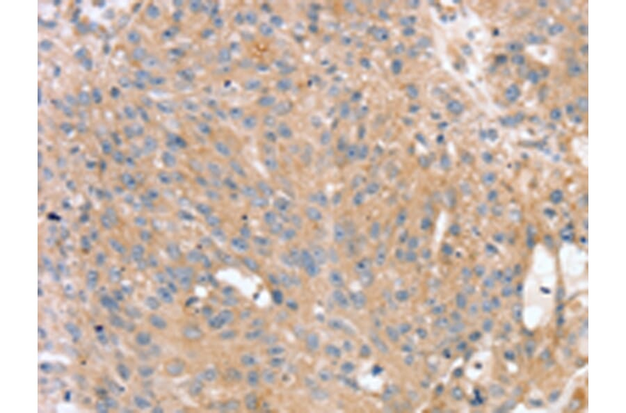 Immunohistochemistry - PTX3 Antibody from Signalway Antibody (43163) - Antibodies.com