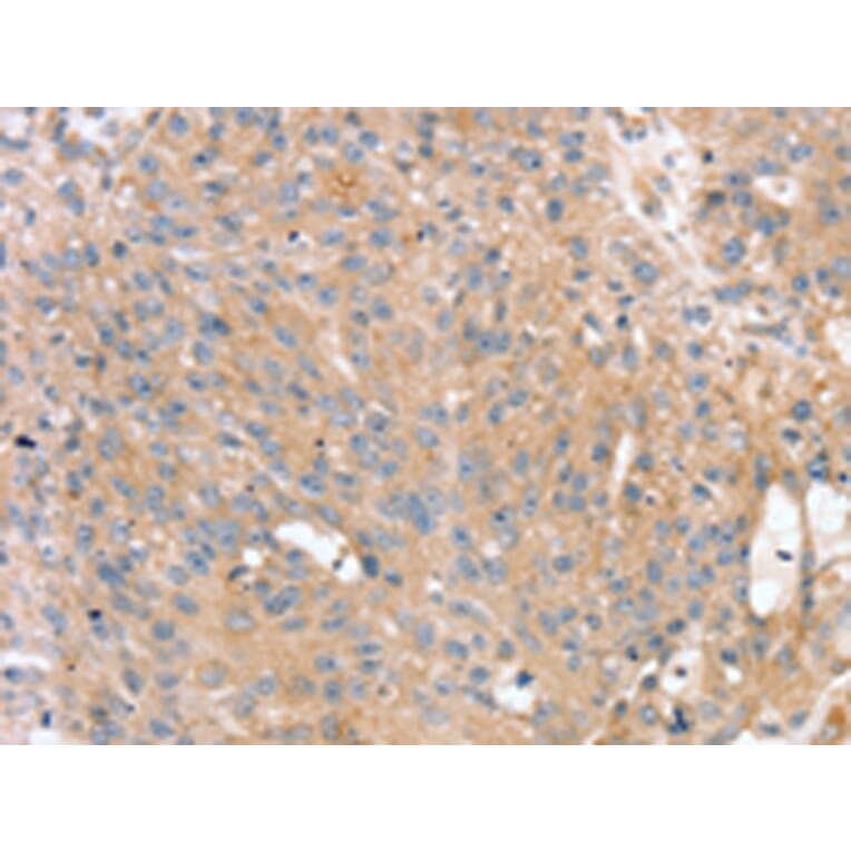 Immunohistochemistry - PTX3 Antibody from Signalway Antibody (43163) - Antibodies.com