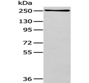 WNK1 Antibody from Signalway Antibody (43183) - Antibodies.com