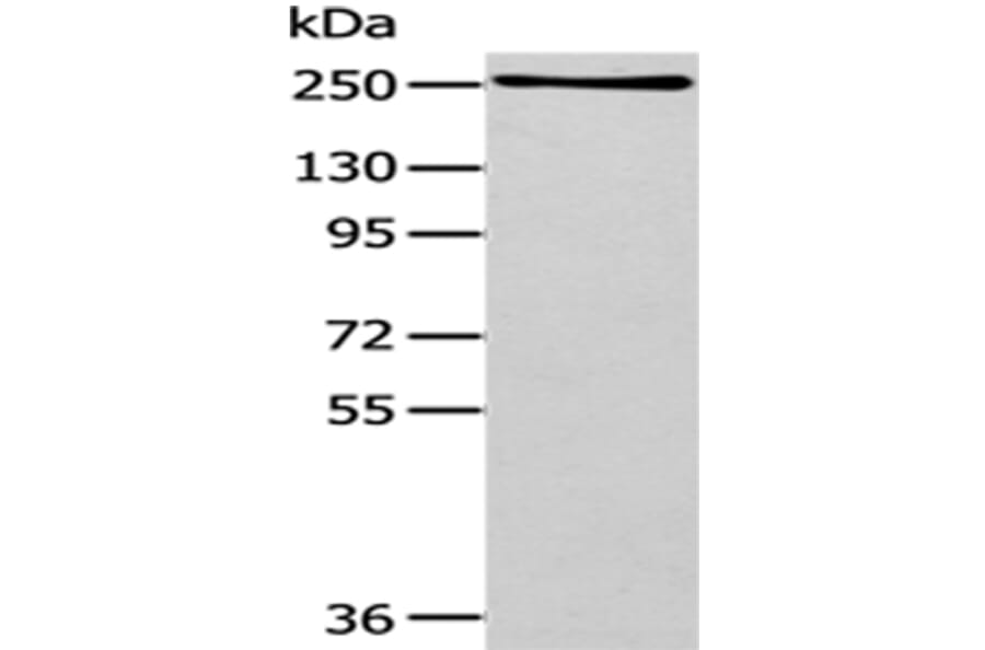 WNK1 Antibody from Signalway Antibody (43183) - Antibodies.com