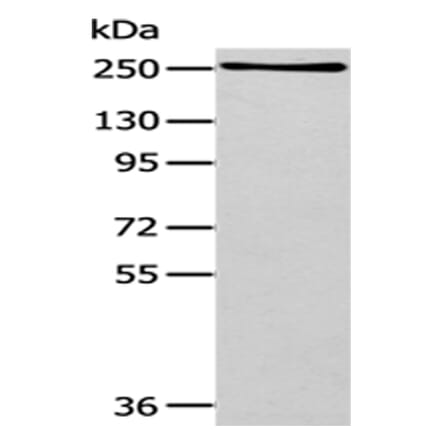 WNK1 Antibody from Signalway Antibody (43183) - Antibodies.com