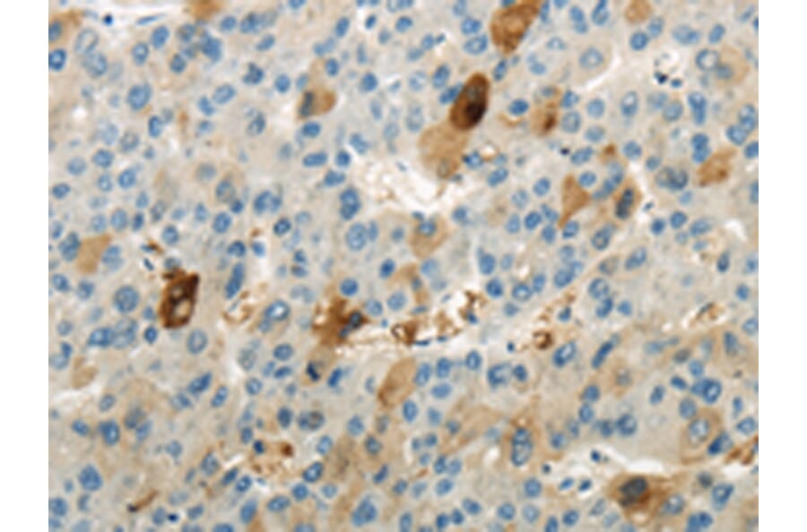 Immunohistochemistry - WNK1 Antibody from Signalway Antibody (43183) - Antibodies.com