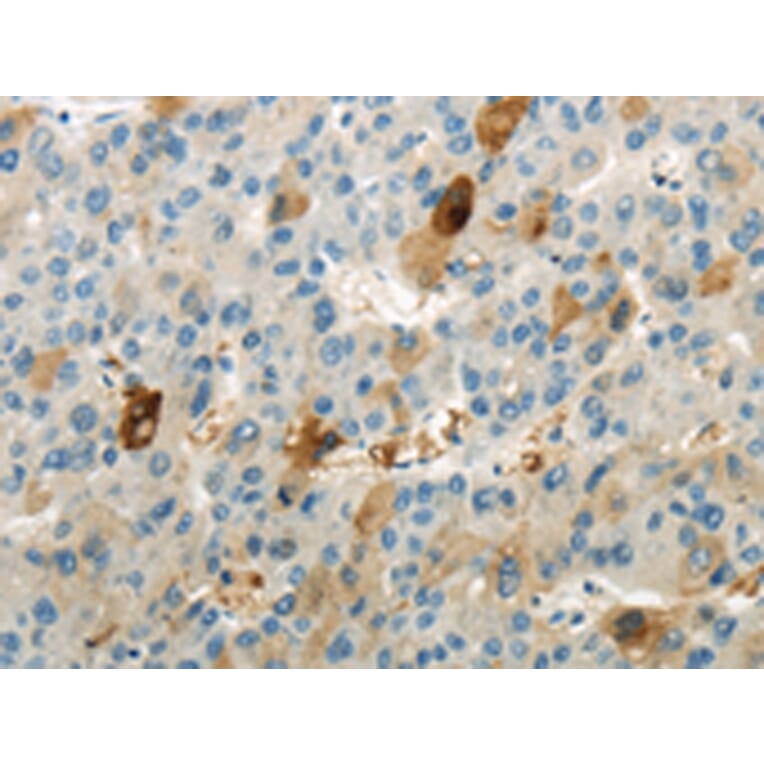 Immunohistochemistry - WNK1 Antibody from Signalway Antibody (43183) - Antibodies.com