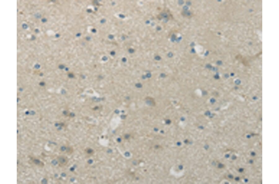 Immunohistochemistry - WNK1 Antibody from Signalway Antibody (43183) - Antibodies.com