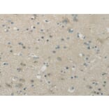 Immunohistochemistry - WNK1 Antibody from Signalway Antibody (43183) - Antibodies.com