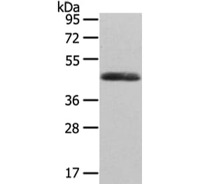 WNT2 Antibody from Signalway Antibody (43192) - Antibodies.com