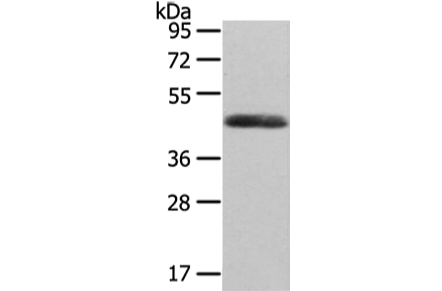 WNT2 Antibody from Signalway Antibody (43192) - Antibodies.com