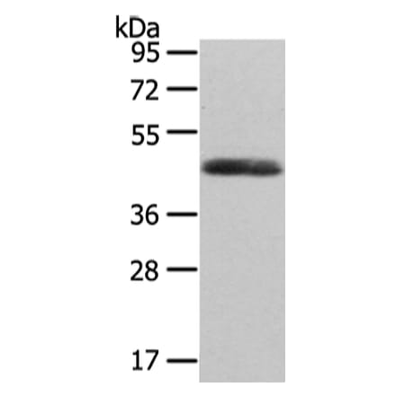 WNT2 Antibody from Signalway Antibody (43192) - Antibodies.com