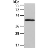 WNT2 Antibody from Signalway Antibody (43192) - Antibodies.com