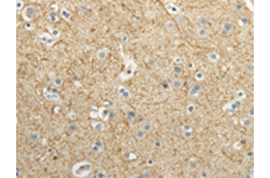 Immunohistochemistry - WNT2 Antibody from Signalway Antibody (43192) - Antibodies.com