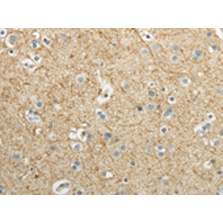Immunohistochemistry - WNT2 Antibody from Signalway Antibody (43192) - Antibodies.com