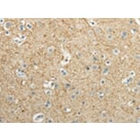 Immunohistochemistry - WNT2 Antibody from Signalway Antibody (43192) - Antibodies.com