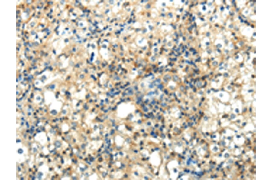 Immunohistochemistry - WNT2 Antibody from Signalway Antibody (43192) - Antibodies.com