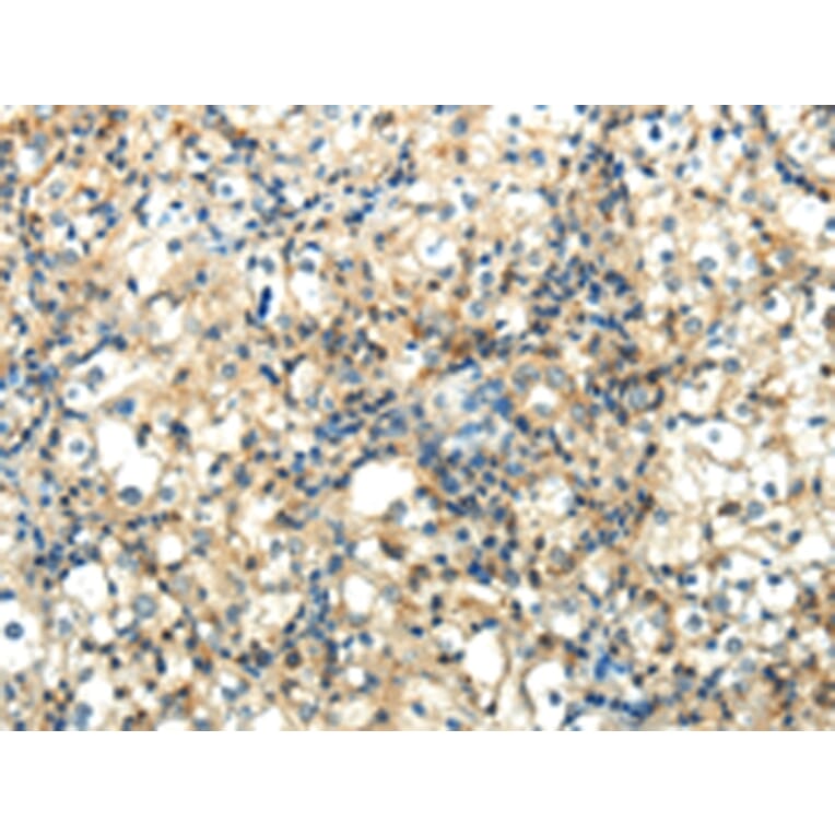 Immunohistochemistry - WNT2 Antibody from Signalway Antibody (43192) - Antibodies.com