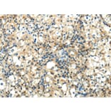 Immunohistochemistry - WNT2 Antibody from Signalway Antibody (43192) - Antibodies.com
