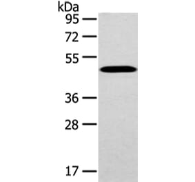 WWOX Antibody from Signalway Antibody (43198) - Antibodies.com