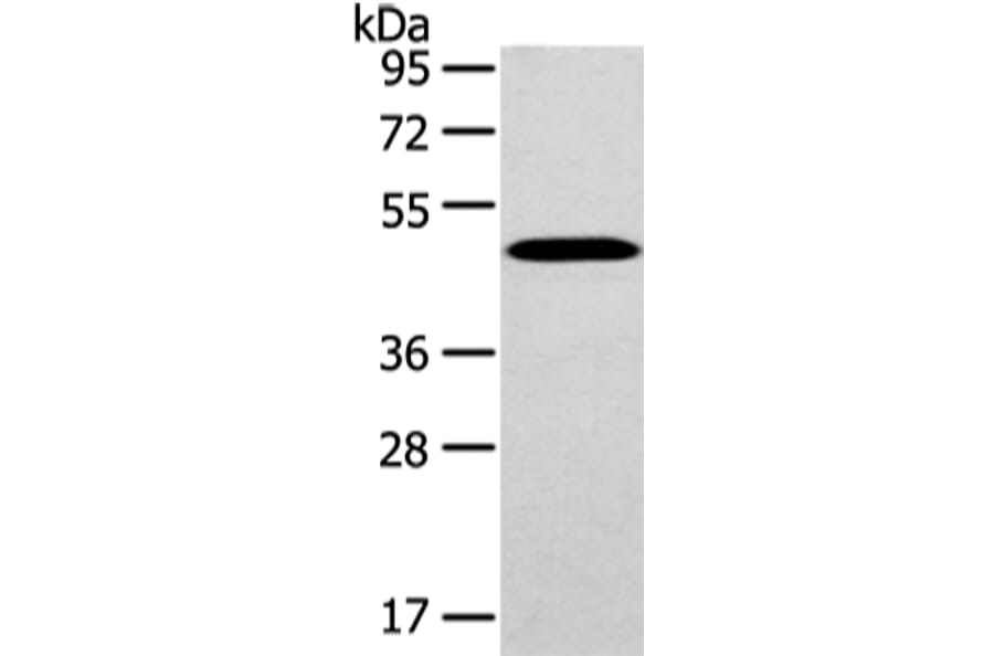 WWOX Antibody from Signalway Antibody (43198) - Antibodies.com