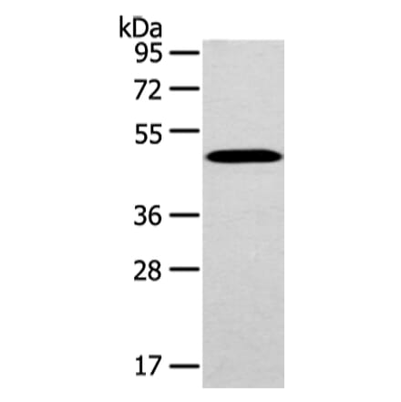 WWOX Antibody from Signalway Antibody (43198) - Antibodies.com