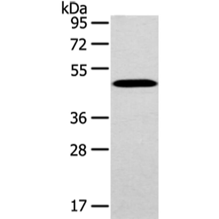 WWOX Antibody from Signalway Antibody (43198) - Antibodies.com