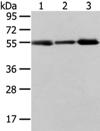 Gel: 8% SDS-PAGE Lysate: 40 &#956;g Lane 1-3: Human normal stomach tissue, human liver cancer and thyroid cancer tissue Primary antibody: 1/400 dilution Secondary antibody: Goat anti rabbit IgG at 1/8000 dilution Exposure time: 2 minutes