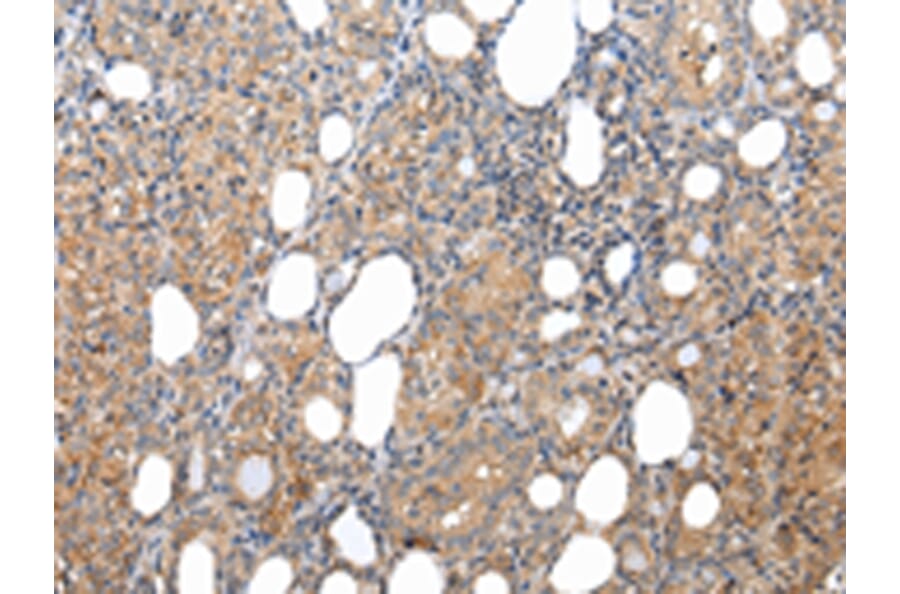 Immunohistochemistry - XKRX Antibody from Signalway Antibody (43203) - Antibodies.com