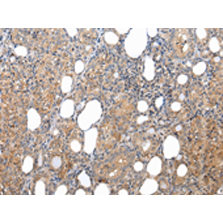 Immunohistochemistry - XKRX Antibody from Signalway Antibody (43203) - Antibodies.com