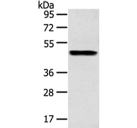ZPR1 Antibody from Signalway Antibody (43210) - Antibodies.com