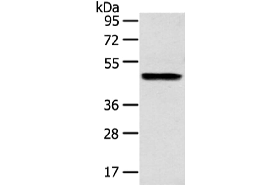 ZPR1 Antibody from Signalway Antibody (43210) - Antibodies.com
