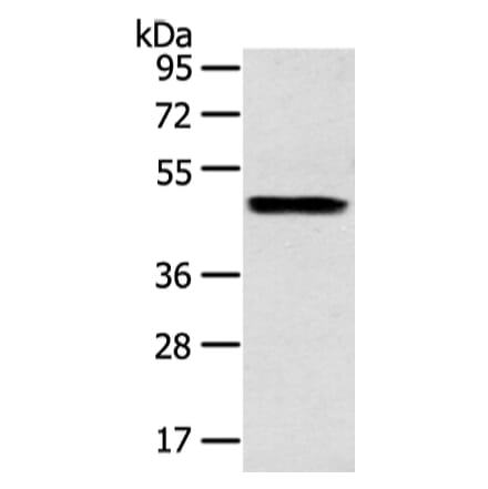 ZPR1 Antibody from Signalway Antibody (43210) - Antibodies.com
