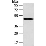 ZPR1 Antibody from Signalway Antibody (43210) - Antibodies.com