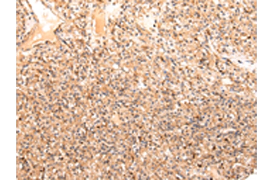 Immunohistochemistry - ZPR1 Antibody from Signalway Antibody (43210) - Antibodies.com