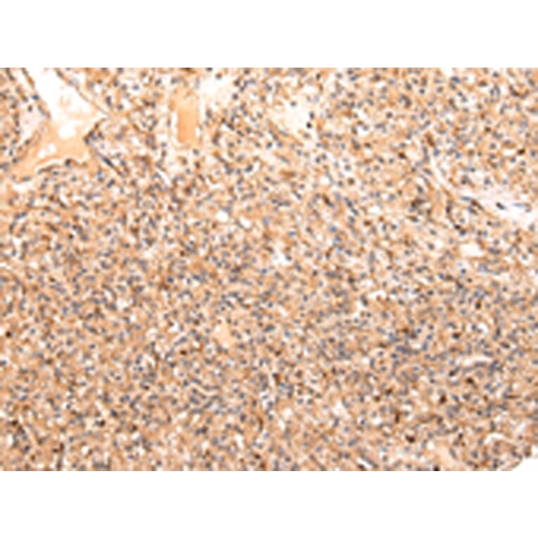 Immunohistochemistry - ZPR1 Antibody from Signalway Antibody (43210) - Antibodies.com
