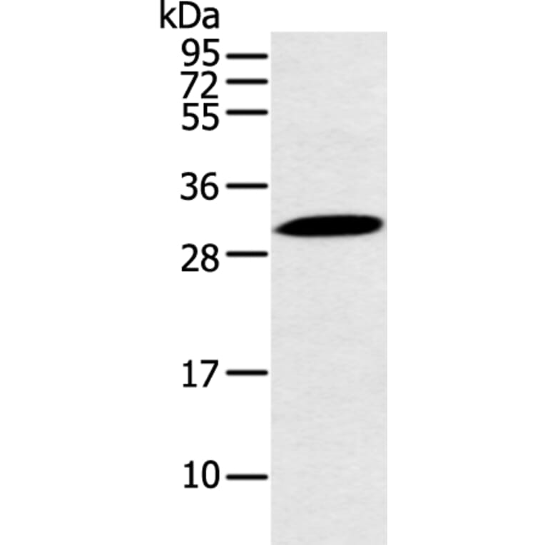 YRDC Antibody from Signalway Antibody (43223) - Antibodies.com