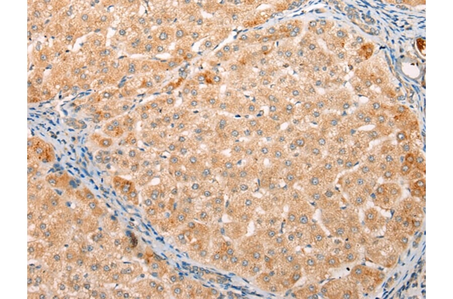 Immunohistochemistry - YRDC Antibody from Signalway Antibody (43223) - Antibodies.com