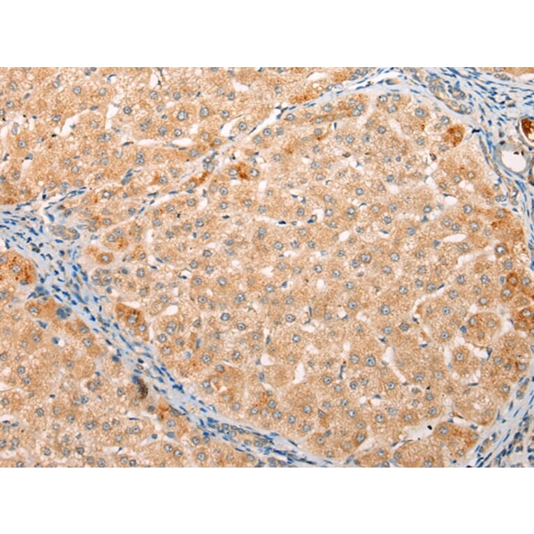 Immunohistochemistry - YRDC Antibody from Signalway Antibody (43223) - Antibodies.com
