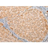 Immunohistochemistry - YRDC Antibody from Signalway Antibody (43223) - Antibodies.com