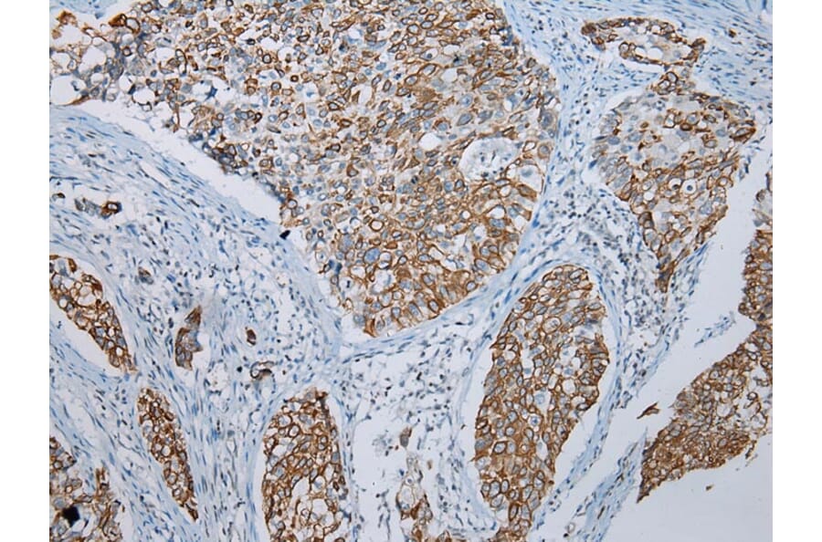 Immunohistochemistry - FGF6 Antibody from Signalway Antibody (43230) - Antibodies.com