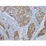 Immunohistochemistry - FGF6 Antibody from Signalway Antibody (43230) - Antibodies.com
