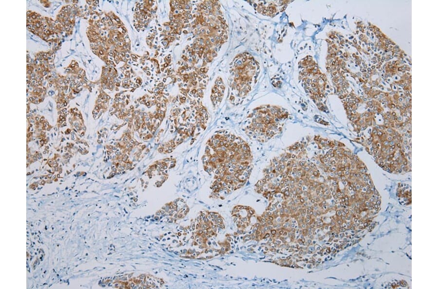 Immunohistochemistry - FGF6 Antibody from Signalway Antibody (43230) - Antibodies.com